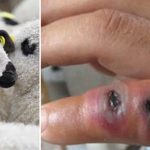 Tată și fiu diagnosticați cu antrax în România, după ce au consumat carne de oaie din gospodărie