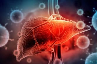 Hepatita A