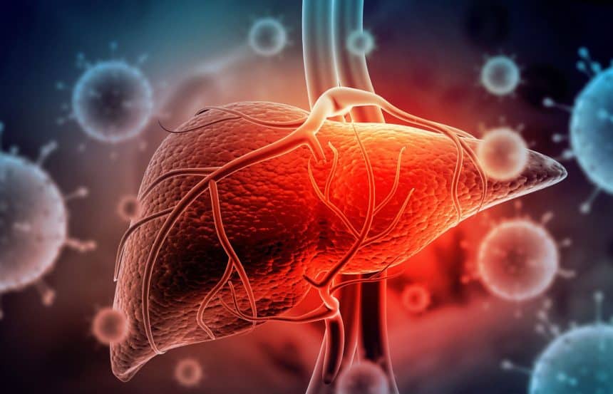 Hepatita A