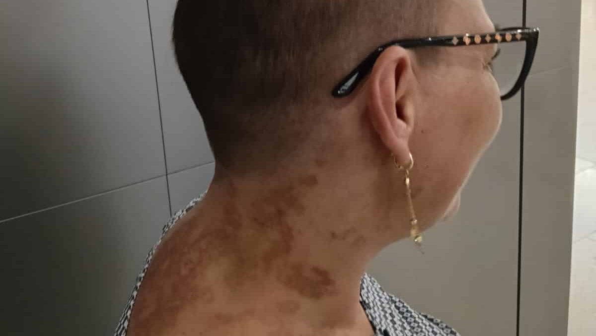 Portret al Andreei Baciu, asistentă la Spitalul Județean din Timișoara, care luptă împotriva unei boli grave.