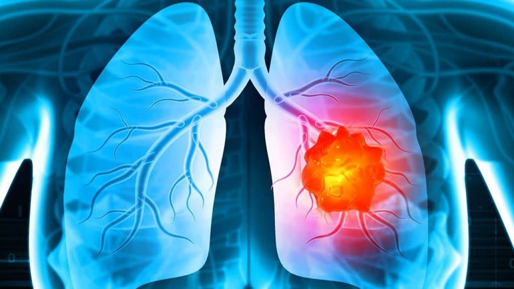 Medic pneumolog analizând o radiografie pulmonară digitală în timpul unei consultații de specialitate.