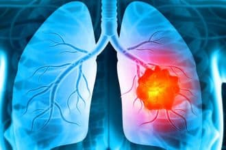 Medic pneumolog analizând o radiografie pulmonară digitală în timpul unei consultații de specialitate.