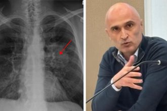 Cristian Oancea atrage atenția că screeningul timpuriu poate salva mii de vieți.