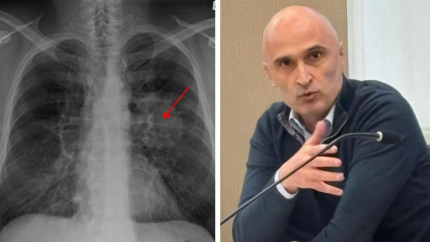 Cristian Oancea atrage atenția că screeningul timpuriu poate salva mii de vieți.