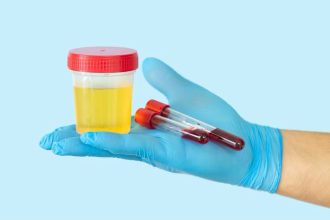 Medicii de la Spitalul Clinic CF Timișoara explică cum pot fi depistate infecțiile, problemele renale sau diabetul