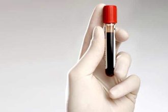 Analiza care depistează prediabetul: Recomandările medicilor din Timișoara